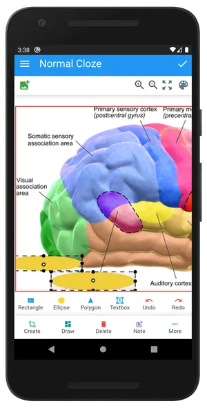 Anki Image Occlusion